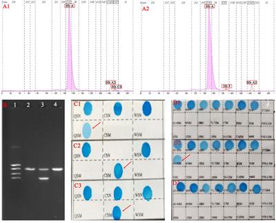 Case report: Prenatal diagnosis in the fetus of a couple with both thalassemia and deafness genes